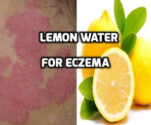  Lemon water for Eczema: Natural Treatment of Eczema