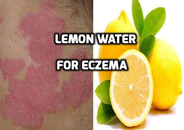 Lemon water for Eczema