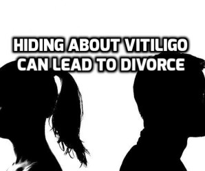  Don’t hide about Vitiligo (Leucoderma) during Marriage discussions