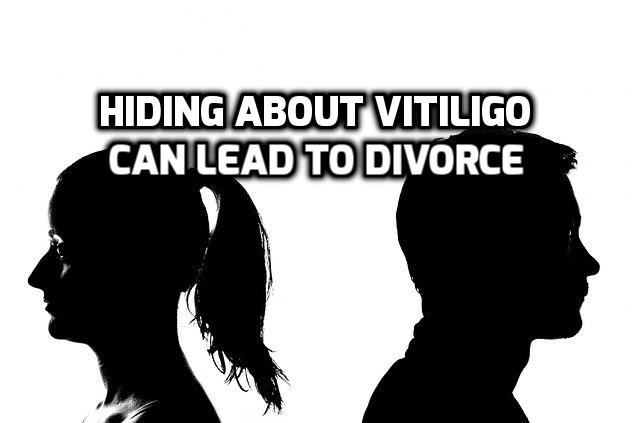 Divorce problem in marriage due to hiding vitiligo leucoderma