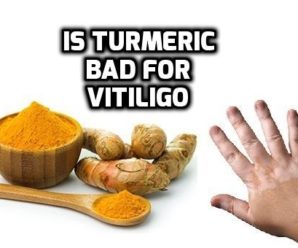  Is Turmeric (Curcumin) Bad for Vitiligo (Leucoderma)
