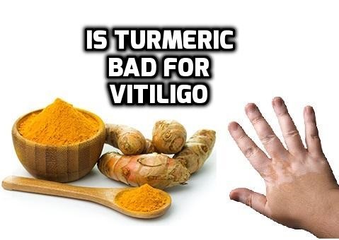 Is turmeric curcumin bad for Vitiligo leucoderma