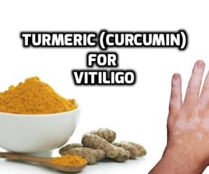  Turmeric (Curcumin) for Vitiligo (Leucoderma) Healing