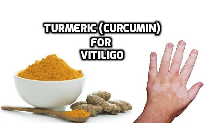 Turmeric Curcumin Vitiligo Leucoderma