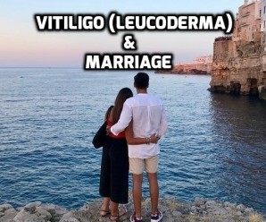  Vitiligo (Leucoderma) and Marriage : Problems and Solutions
