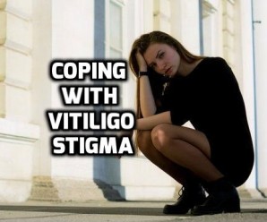  Vitiligo Stigma: How to overcome it