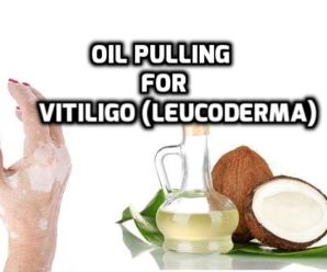  Oil pulling for Vitiligo: How effective it is?