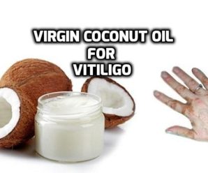  How to use Virgin Coconut Oil for Vitiligo