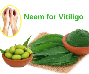 Neem leaves oil tablets Vitiligo leucoderma