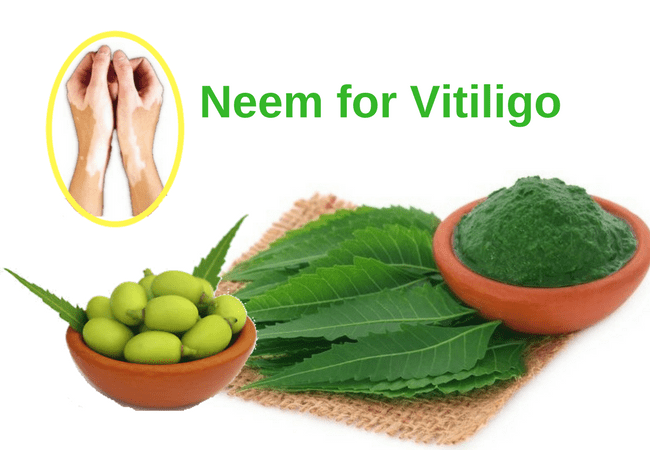 Neem leaves oil tablets Vitiligo leucoderma