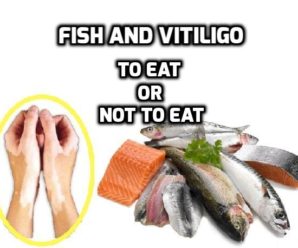  Fish and Vitiligo (leucoderma) : To eat or not to eat