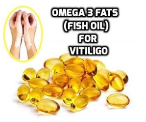  Fish oil (Omega 3 fats) for Vitiligo healing