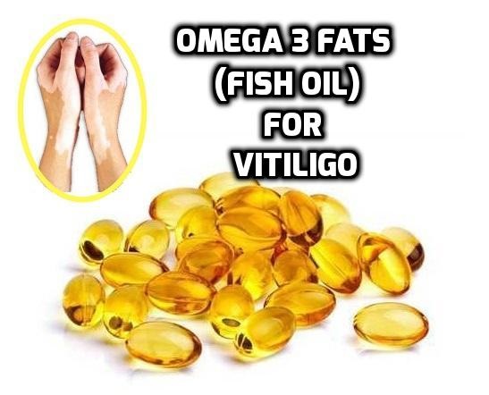 fish oil omega 3 fatty acids vitiligo leucoderma