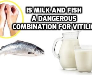  Does taking Milk and Fish together causes Vitiligo?