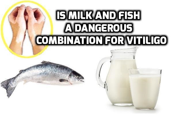 Is consuming milk or curd together with fish causes vitiligo leucoderma white spots