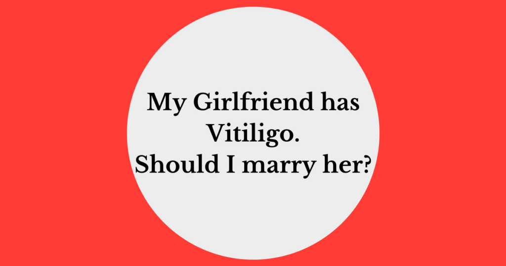 Girlfriend Vitiligo Marriage Romance Dating