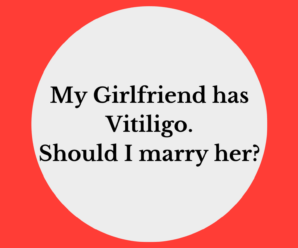  My Girlfriend has Vitiligo (Leucoderma). Should I marry her?