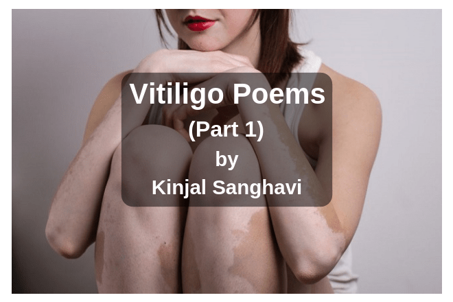Vitiligo Poems part 1 Kinjal Sanghavi
