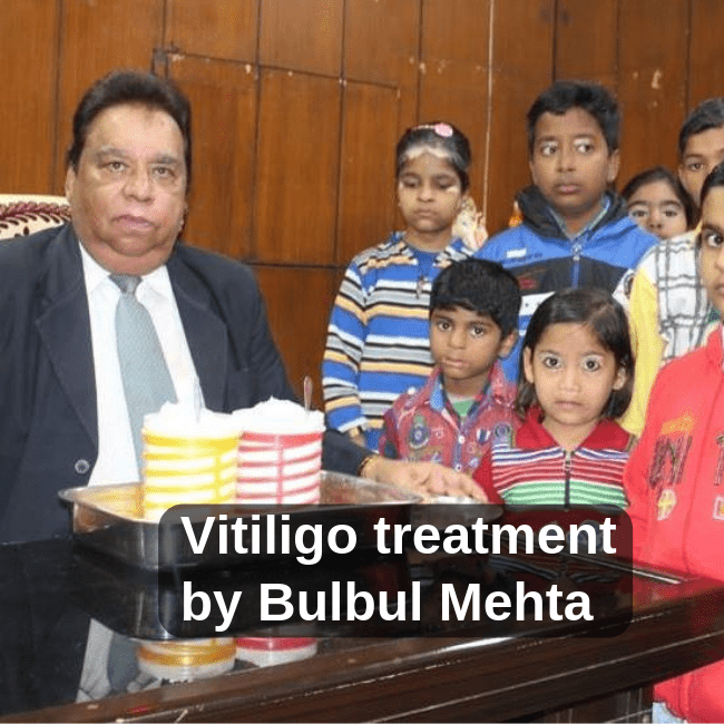 Bulbul Mehta Vitiligo leucoderma safed daag treatment Delhi