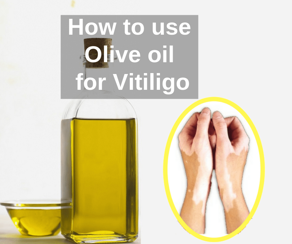 Extra Virgin Olive Oil Vitiligo Leucoderma