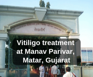  Vitiligo treatment at Manav Parivar, Matar, Gujarat