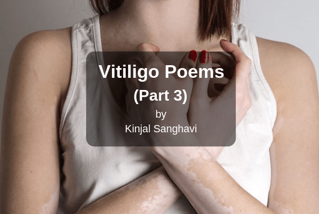 Vitiligo Leucoderma Poems part 3