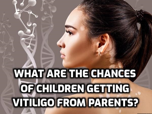 What are the chances of children getting vitiligo from parents
